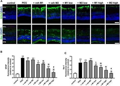 Increased efficacy of dietary supplement containing wax ester-rich marine oil and xanthophylls in a mouse model of dry macular degeneration